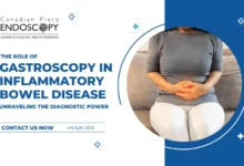 role of gastroscopy