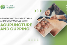 Acupuncture and Cupping Therapy Benefits